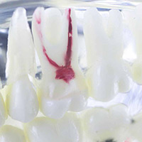Dental Pulp Dental Pulp
